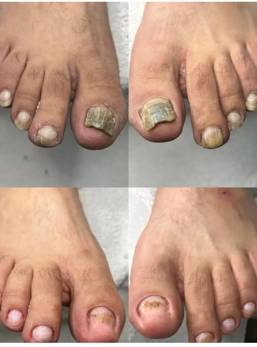 Zeynep Ergin Ayak Sağlığı Merkezi